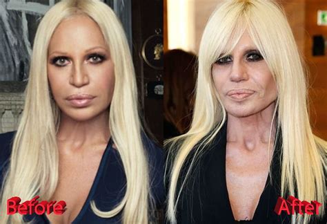 donatella versace assistente|donatella versace before and after.